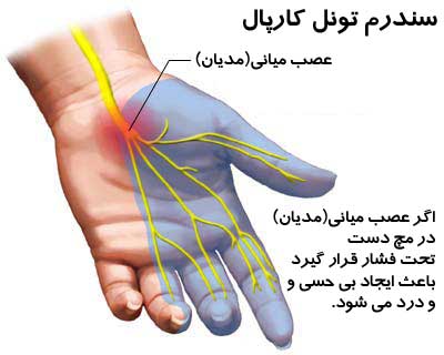 علت درد دست چپ