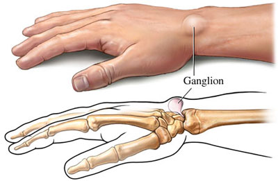 علت درد دست چپ چیست؟